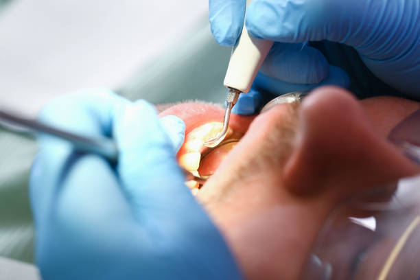 Best Emergency Dental Care for Broken or Chipped Teeth in Wilburton, OK