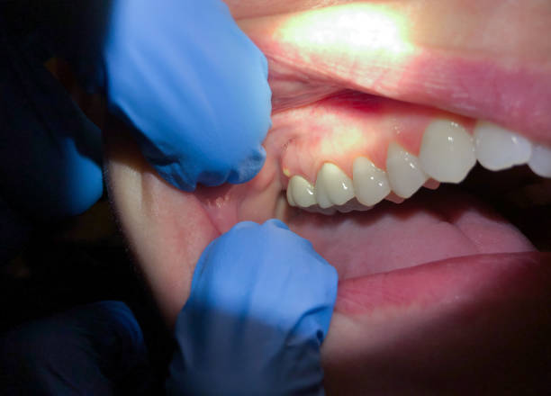 Best Same-Day Emergency Dental Services in Wilburton, OK