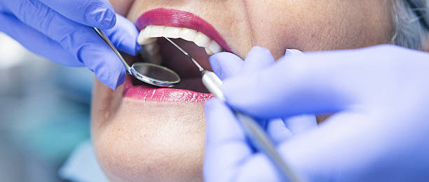 Best Emergency Tooth Extraction in Wilburton, OK